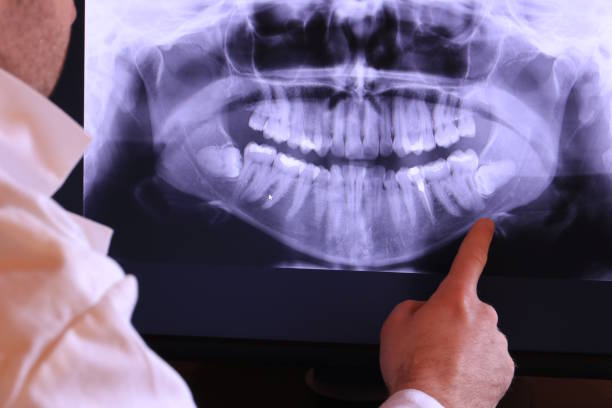 Best Emergency Dentist for Knocked-Out Tooth in Center Point, TX