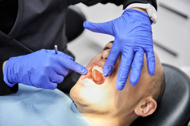 Best Emergency Dentist for Knocked-Out Tooth in Center Point, TX
